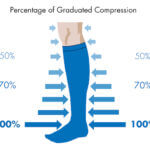 Compression Stockings for venous reflux