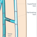 Perforator Vein Anatomy with labeled veins